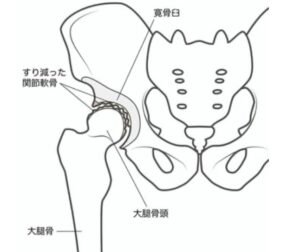 股関節